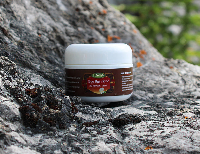 Bye Bye Acne